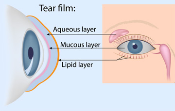 eye exam